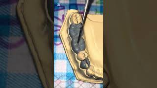 Primer molar inferior [upl. by Aoniak]