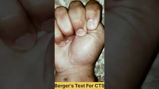 Bergers Test For Carpal Tunnel Syndrome 😍  Physio Cure [upl. by Yelnek]