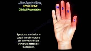 Median nerve injury causes symptoms diagnosis and treatment Carpal tunnel syndrome diagnosis [upl. by Accever]