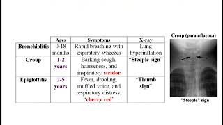 USMLE ACE Video 74 Epiglottitis Croup Bronchiolitis [upl. by Shae]