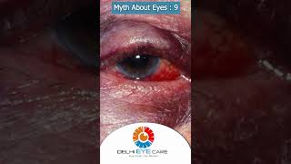 Myth 9 An Eye Injury Isn’t Serious if There’s No Pain  eyefacts eyecare delhieyecare [upl. by Hailee]