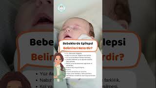 Bebeklerde Epilepsi Belirtileri Nelerdir [upl. by Veradi]