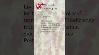 Codocytes  Target cells ilovepathology pathology hemepath [upl. by Tomas]