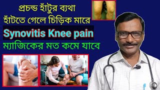 Synovitis knee pain  joint lining inflammation  হাঁটু ব্যথার দ্রুত উপশম  Dr SP Goswami [upl. by Eiahpets613]