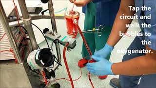 ECMO Troubleshooting Air Embolism [upl. by Cyrille]