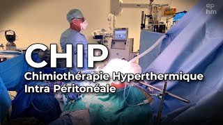 La CHIP  Chimiothérapie Hyperthermique Intra Péritonéale [upl. by Atihcnoc844]