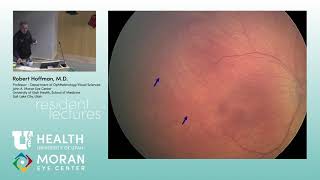 Retinopathy of Prematurity [upl. by Mall]