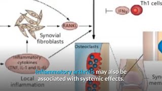 Inflammatory Polyarthritis Vs Rheumatoid Arthritis [upl. by Yeung]