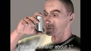 3D Medical Animation Inhaler [upl. by Opal]