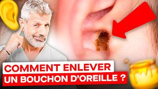 Comment Enlever un Bouchon de Cérumen  huile dolive bougies 😮 [upl. by Key266]