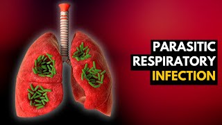 Parasitic Respiratory Infection What Is This And How Do You Treat It [upl. by Retnuh332]