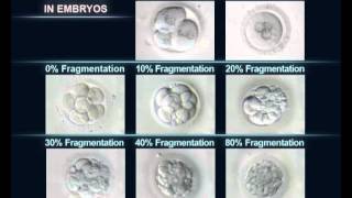 Classification des embryons FIV par leur degré de fragmentation [upl. by Jennie]