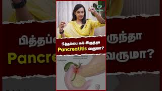 பித்தப்பை கல் இருந்தா Pancreatitis வருமா  Causes of Pancreatitis  DrPreethi Mrinalini [upl. by Nicholle]