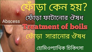 ফোঁড়ার হোমিওপ্যাথিক  চিকিৎসা  Treatment  of boils  is homeopathic  Dr Arif Hossain [upl. by Glendon]