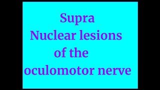 Supranuclear lesions of Oculomotor Nerve [upl. by Pollack471]