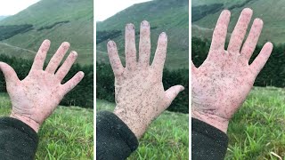 Giant Swarm Of Midges Stick To Hand In Scotland [upl. by Htiaf394]