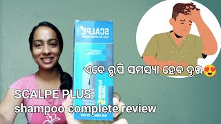 scalpe plus shampoo  scalpe plus shampoo review shortsofmonali [upl. by Haroved]