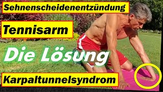 ✅ TENNISARM amp Sehnenscheidenentzündung amp Karpaltunnelsyndrom mit diesen Dehnübungen heilen 👇 [upl. by Hakvir806]