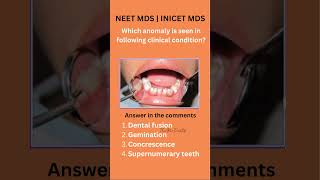 NEET MDS amp INICET MDS 2025 preparation  Oral pathology previous year important topic [upl. by Iand62]