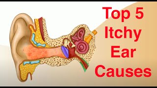 Top 5 Causes of Itchy Ears and Treatment Too [upl. by Srevart]