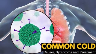 Common Cold Causes Signs and Symptoms Diagnosis and Treatment [upl. by Kikelia350]