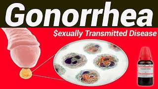 Gonorrhea homeopathic treatment [upl. by Herv]