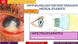 Infectious Keratitis STATE OF THE ART DIAGNOSIS AND MANAGMENT LECTURE 2 Bacterial KERATITIS [upl. by Fagin]