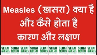 Measles खसरा क्या है और कैसे होता है कारण और लक्षण Measles Symptoms Causes [upl. by Ahsitel]