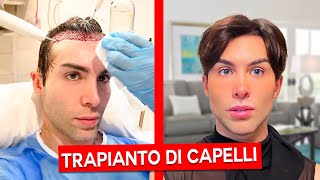 TRAPIANTO DI CAPELLI LA MIA ESPERIENZA  GIANMARCO ZAGATO [upl. by Markland]