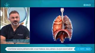 Dolaşım bozukluğu Tromboflebit DVT neden en çok bacak ayaklarda olur  Prof Dr Ahmet AKGÜL [upl. by Roxine605]