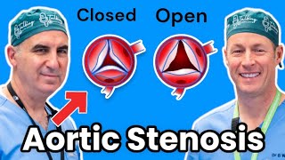 Aortic Stenosis and the TAVI Procedure Insights from a Cardiologist [upl. by Harrow311]