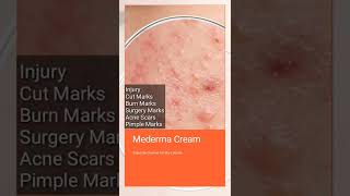 Mederma Cream For Injury Cut Marks Burn Marks Surgery Scar Scne Scar Pimple Marks [upl. by Anitrebla706]