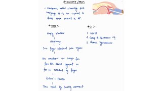 AMNIOTOMYAROM NOTES  OBSTETRICS  OBGY  ONE PAGE NOTES  4TH PROFF  MBBS [upl. by Boru]