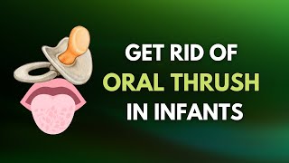 Prevent Oral THRUSH in Babies  Oral Candidiasis [upl. by Enitsrik]