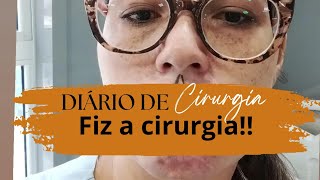 Fiz a cirurgia de reconstrução labial [upl. by Lupien]