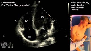 Apical 4 Chamber View on Transthoracic Echocardiography Cardiac Ultrasound [upl. by Anniahs]