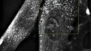 Noninvasive labelfree visualization of melanin granules using Nanolive cell imaging [upl. by Jadd]