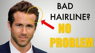 5 Awesome Hairstyles for Widows Peak  Receding Hairline [upl. by Gristede370]