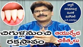 Bleeding Gums Causes and Ayurvedic Treatment in Telugu by Dr Murali Manohar Chirumamilla MD [upl. by Ahsein]