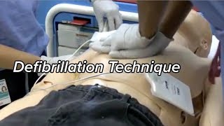 How to Defibrillate  Defibrillation Technique [upl. by Heida945]