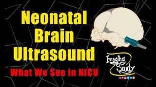 Neonatal Brain Ultrasound  What We See in NICU  Imaging Study Lecture [upl. by Willette]