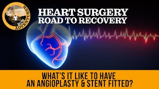 Whats it like to have an angioplasty amp stent fitted a patients perspective of heart surgery [upl. by Kant199]