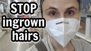 Shaving tips to prevent ingrown hairs shopping for Fall decor Dr Dray [upl. by Diandre]