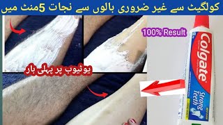 INSTANTLY REMOVE UNWANTED HAIR No WaxNo THREADING in UrduHindi [upl. by Neehsuan685]