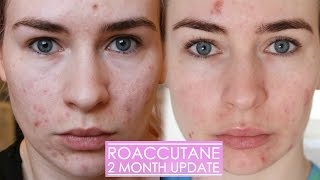 2 MONTH ROACCUTANE UPDATE  Side effects amp my skin now [upl. by Adnolay636]