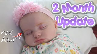 Reflux amp Milk Allergy  2 MONTH BABY UPDATE [upl. by Vanthe]