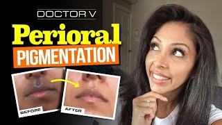 Doctor V  Perioral Pigmentation  Skin Of Colour  Brown Or Black Skin [upl. by Nireil]