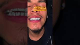 Teeth Grillz [upl. by Alic]