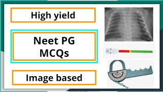 Neet Pg MCQ Pediatric subject high yield mbbs neetpgpreperation pediaticlectureformedicalstudent [upl. by Erdnaet]