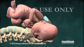 Nucleus Obstetrics and Gynecology Demo 2010 [upl. by Dareen285]